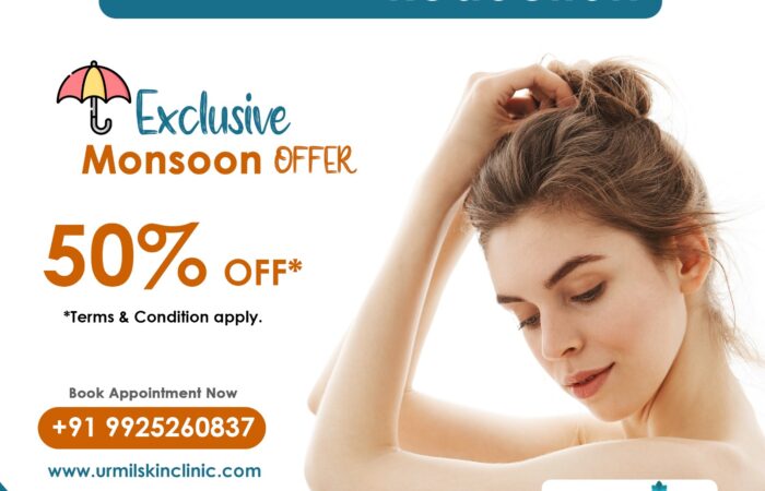laser hair removal discount